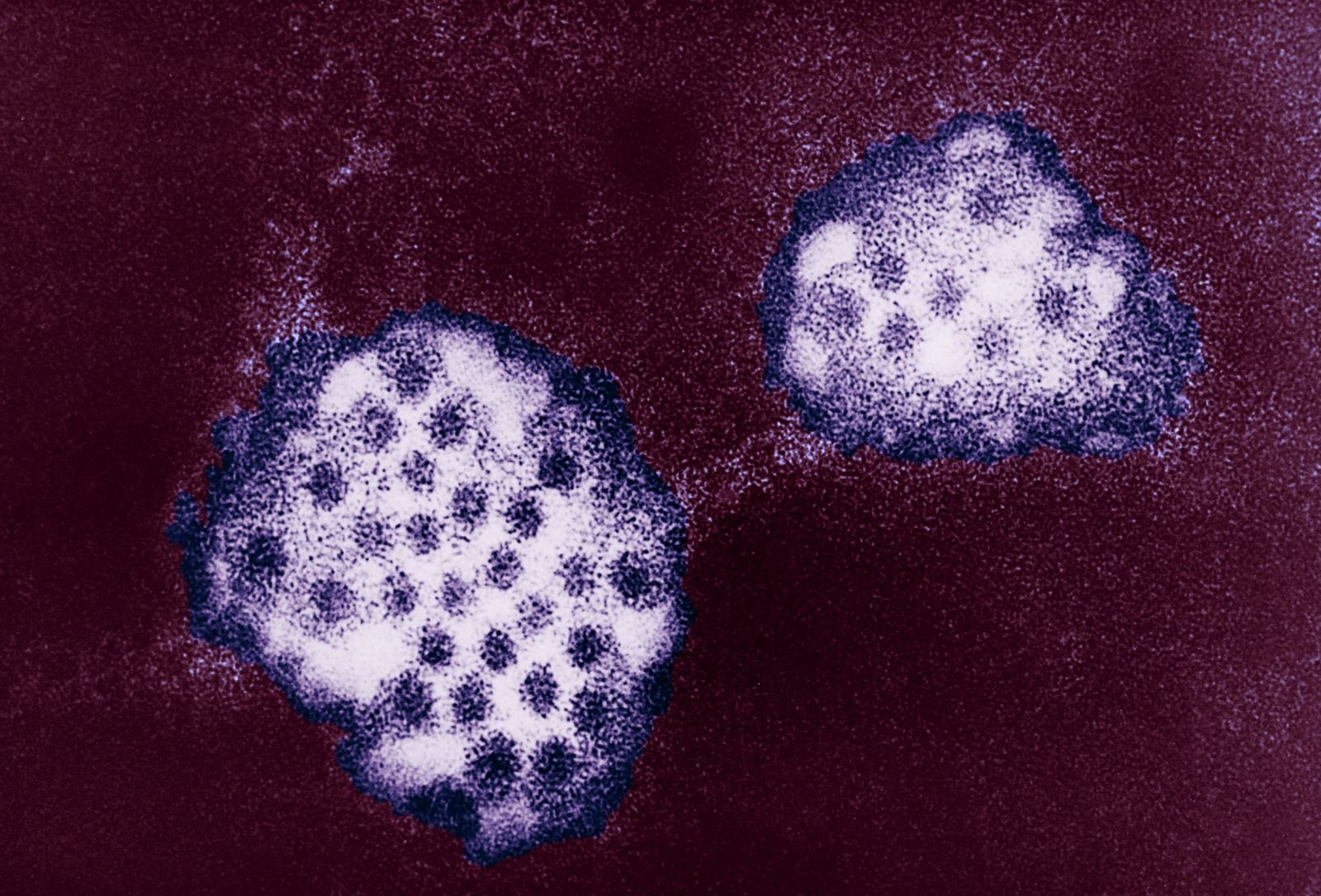 novovirus-cum-da-day.jpg