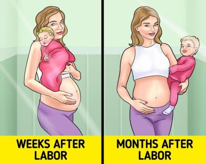  đường sọc nâu bụng bầu 2