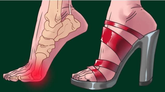 ảnh hưởng khi đi giày cao gót 0 ảnh hưởng khi đi giày cao gót 0