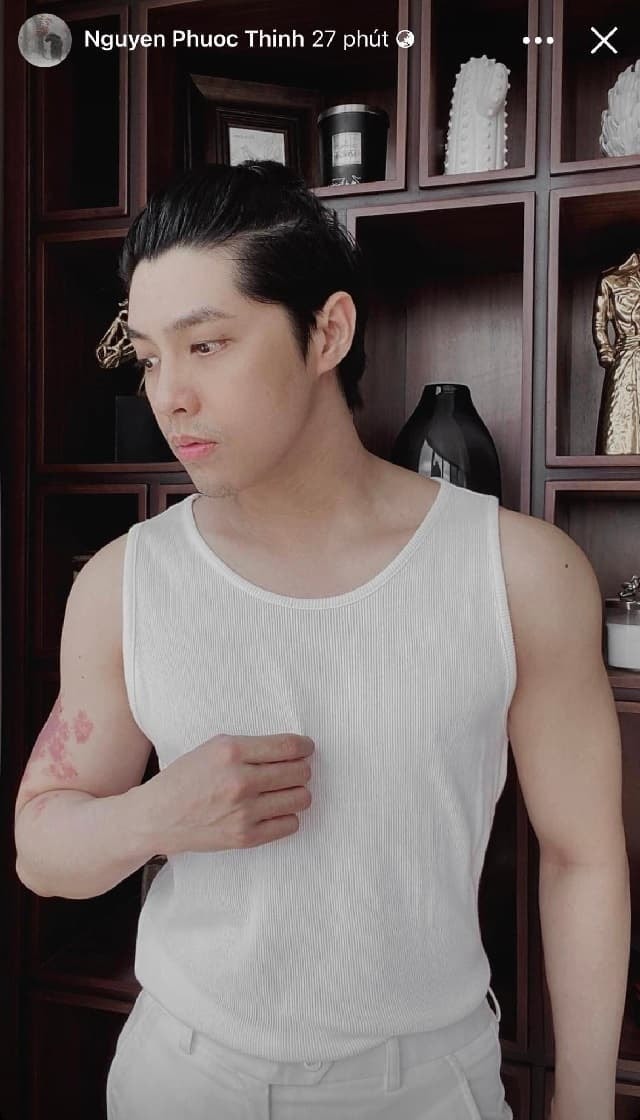 noo-phuoc-thinh-khoe-co-bap-cuon-cuon-de-lo-dau-hieu-doc-nhat-vo-nhi-tren-canh-tay-trai-291-6139703.jpg 1 noo-phuoc-thinh-khoe-co-bap-cuon-cuon-de-lo-dau-hieu-doc-nhat-vo-nhi-tren-canh-tay-trai-291-6139703.jpg 1