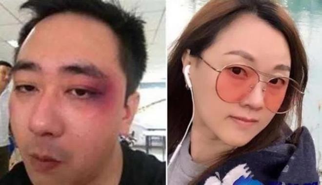 Vương Tự Kiện bị vợ bạo hành 3 Vương Tự Kiện bị vợ bạo hành 3