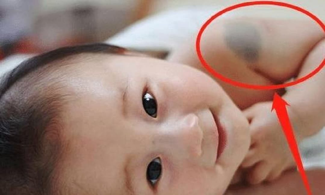 Ngo&agrave;i di truyền, nguy&ecirc;n nh&acirc;n khiến trẻ c&oacute; vết bớt th&igrave; 3 h&agrave;nh vi n&agrave;y khi  mang thai cũng l&agrave; một trong những 'thủ phạm'