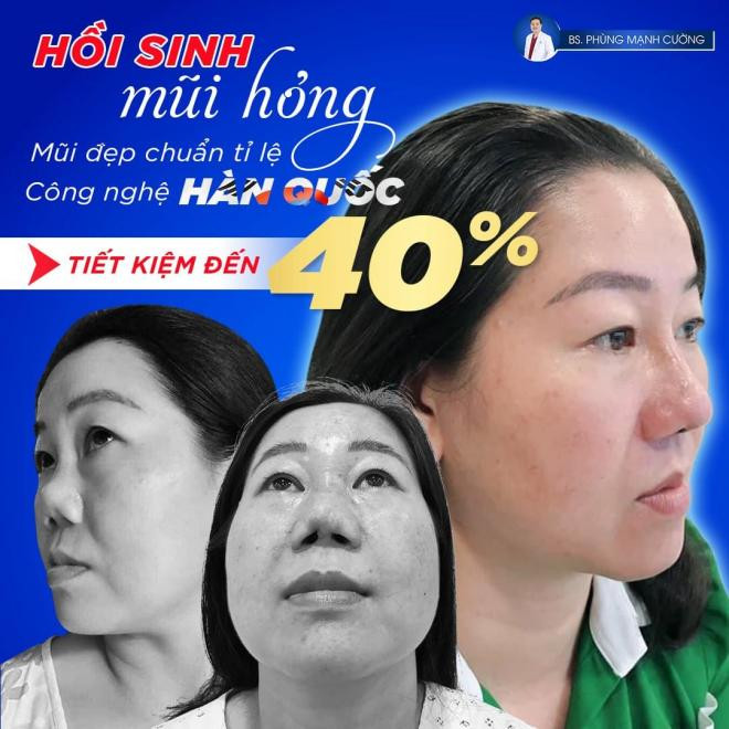 bs-tham-my-phung-manh-cuong-175 (1).jpg 0