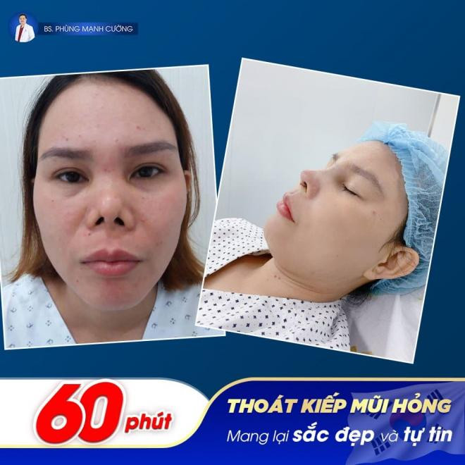 bs-tham-my-phung-manh-cuong-175 (1).jpg 0