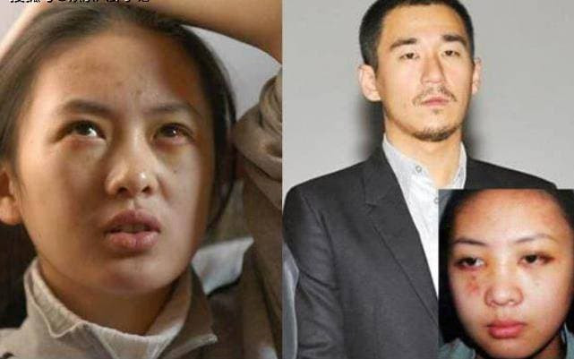 'Tiểu Chương Tử Di' suýt là con dâu tương lai của Trương Quốc Lập, bị hủy hoại bởi bạo lực, sau này kết hôn với một người giàu có ở tuổi 34 3