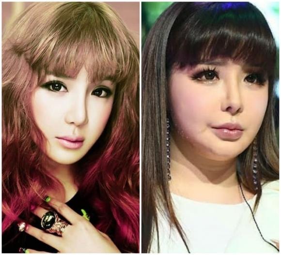phẫu thuật thẩm mỹ, khuôn mặt biến dạng của sao Hàn, Jion (N.Tic), Yuta (NCT), Jimin (cựu AOA), Park Bom