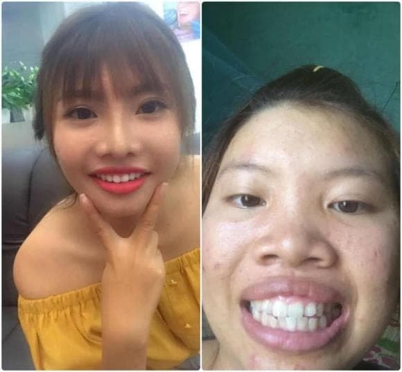 'Thị Nở tái sinh, Quách Phượng, giới trẻ dao kéo 
