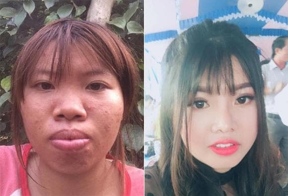 'Thị Nở tái sinh, Quách Phượng, giới trẻ dao kéo 