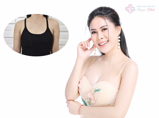 nâng ngực nội soi, Bệnh viện Thẩm mỹ Ngọc Phú, Phẫu thuật thẩm mỹ