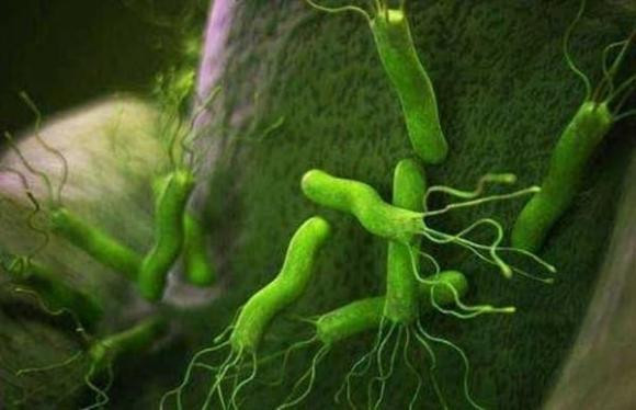vi khuẩn HP, nhiễm khuẩn HP, trào ngược dạ dày