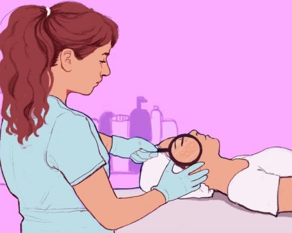 mụn trắng, mụn trắng ở gần mắt, sức khỏe 