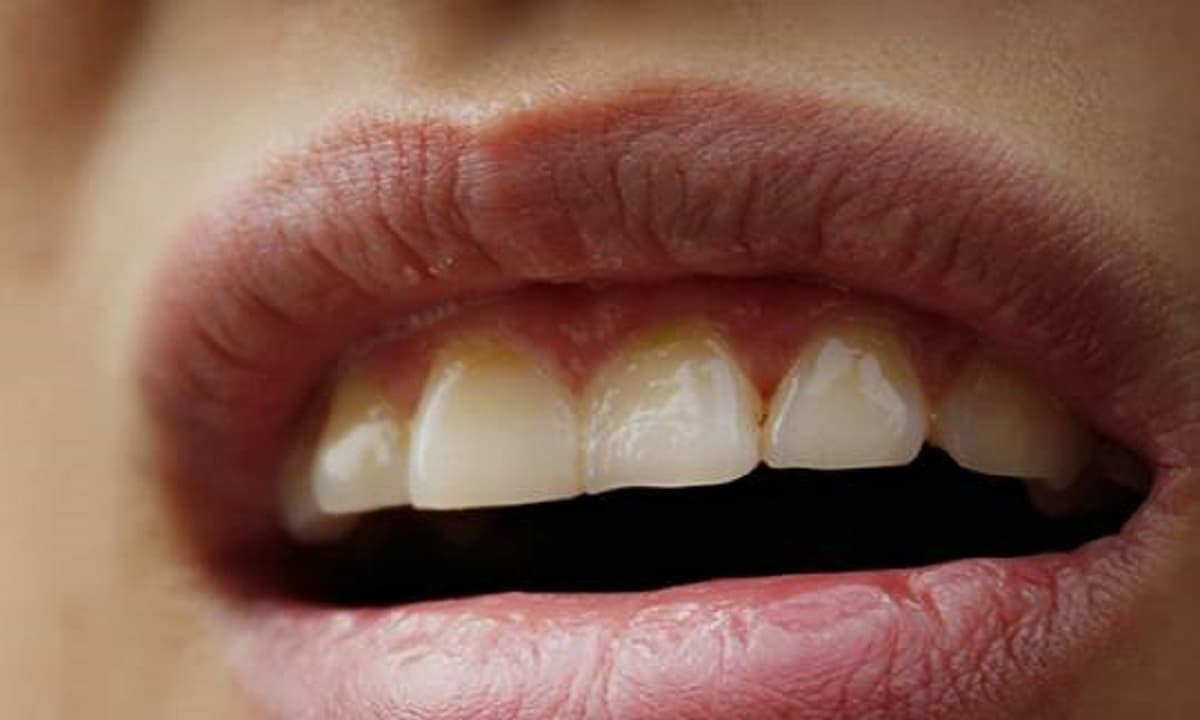 Liệu miệng đắng có liên quan đến vấn đề sức khỏe nào khác không?
