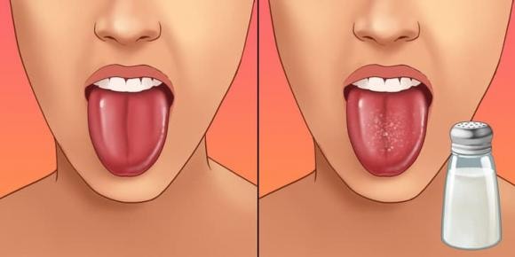 stress, cách giảm căng thẳng, áp lực công việc 