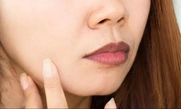 môi thâm, môi thâm đánh son không đẹp, làm sao hết môi thâm, làm đẹp 