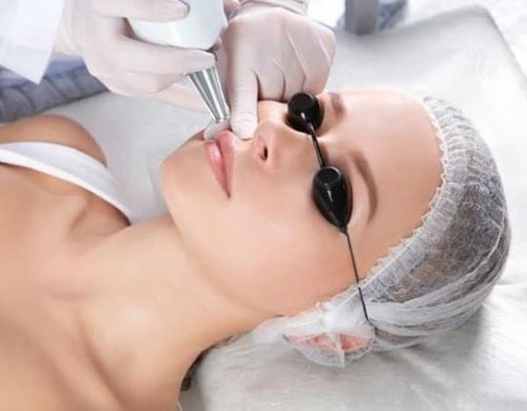 môi thâm, môi thâm đánh son không đẹp, làm sao hết môi thâm, làm đẹp 