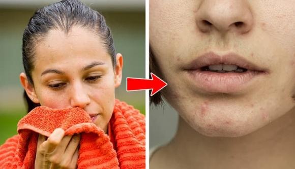 mụn mọc, mọc mụn, tại sao mọc mụn 