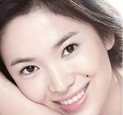 xem bói nốt ruồi, nốt ruồi giàu sang, bói nốt ruồi