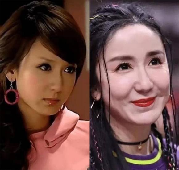 mỹ nhân Cbiz phẫu thuật thẩm mỹ, sao Hoa ngữ, Lâu Nghệ Tiêu, Lý Tiểu Lộ, Trương Mông, Trịnh Sảng, Tôn Phi Phi
