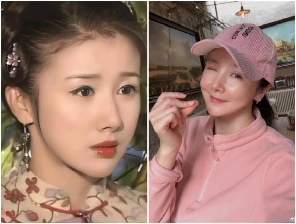 mỹ nhân Cbiz phẫu thuật thẩm mỹ, sao Hoa ngữ, Lâu Nghệ Tiêu, Lý Tiểu Lộ, Trương Mông, Trịnh Sảng, Tôn Phi Phi