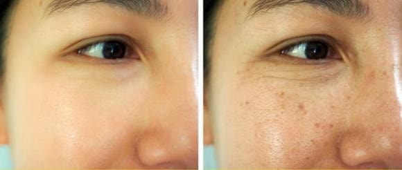 ăn đường, không ăn đường, tác hại của ăn đường