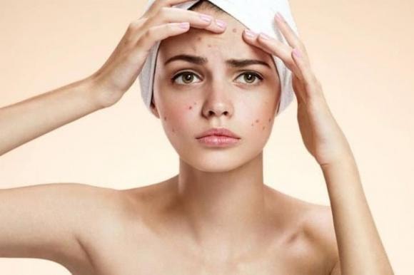 dưa chuột, mặt nạ dưa chuột, làm đẹp
