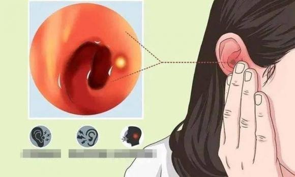 ngứa tai, dáy tai, bệnh về tai