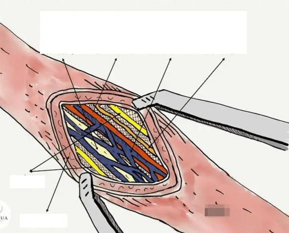 đồ lót nam, túi trước quần lót nam, nội y, đàn ông