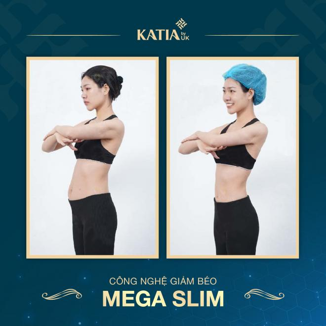 Mega slim, công nghệ giảm béo an toàn, Thẩm mỹ viện Katia