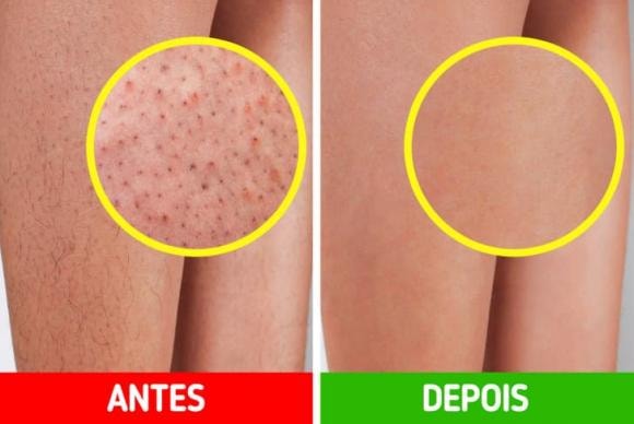 chăm sóc, da, lỗ chân lông, dâu tây