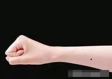 nốt ruồi, vị trí nốt ruồi, nốt ruồi son, nốt ruồi may mắn