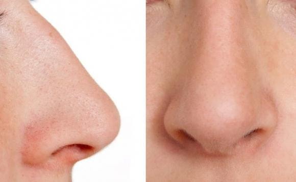 cơ thể người, nước bọt, kiến thức