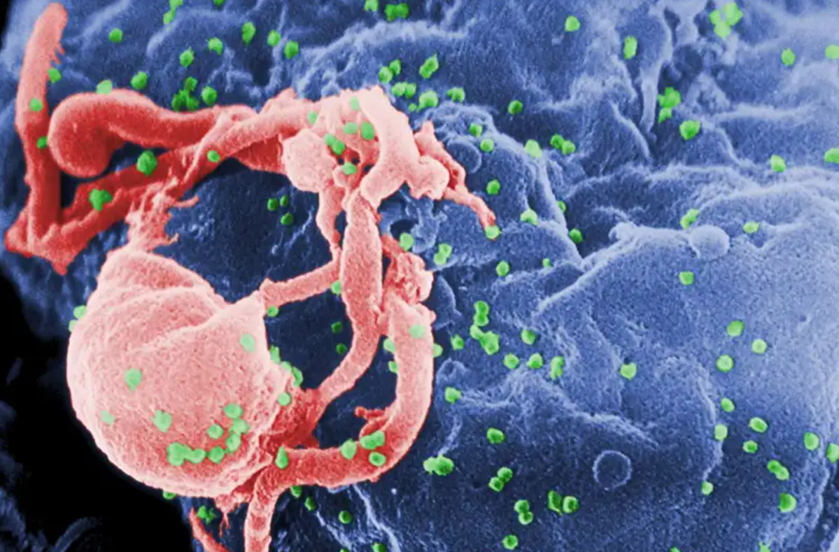 Người thứ 5 khỏi HIV nhờ ghép tế bào gốc
