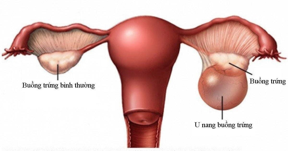 316-202509122204391.png