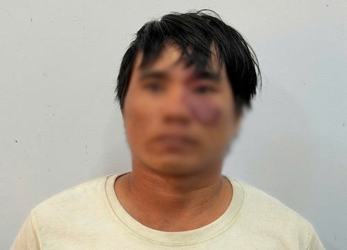 Con nợ cố ý gây thương tích làm chủ nợ tử vong