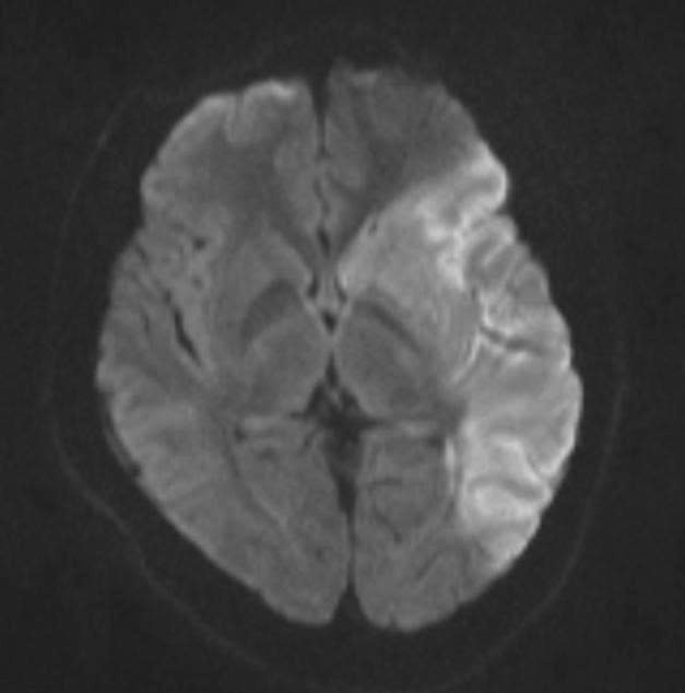 phim-mri-ca-benh.jpg