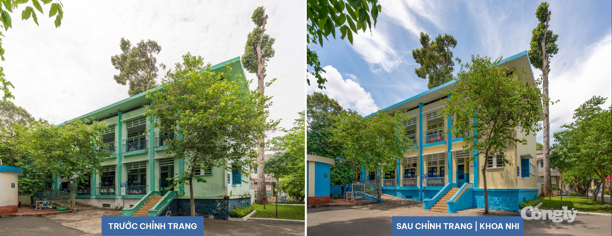 Khoa nhi Before After