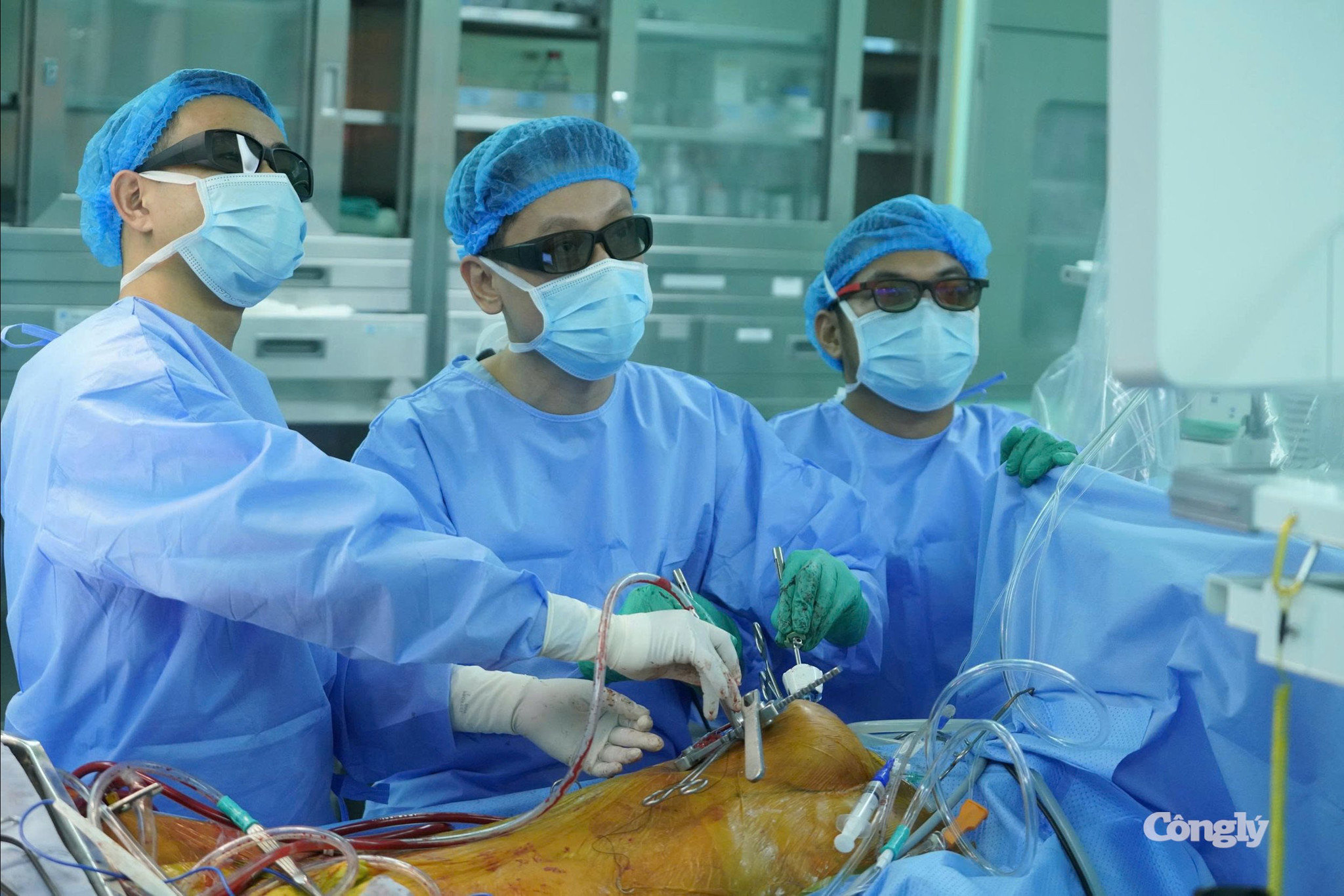 Phẫu thuật nội soi xâm lấn tối thiểu đòi hỏi sự phối hợp chặt chẽ của ê kíp và kỹ thuật thao tác chính xác trong không gian phẫu trường hẹp nhằm xử l