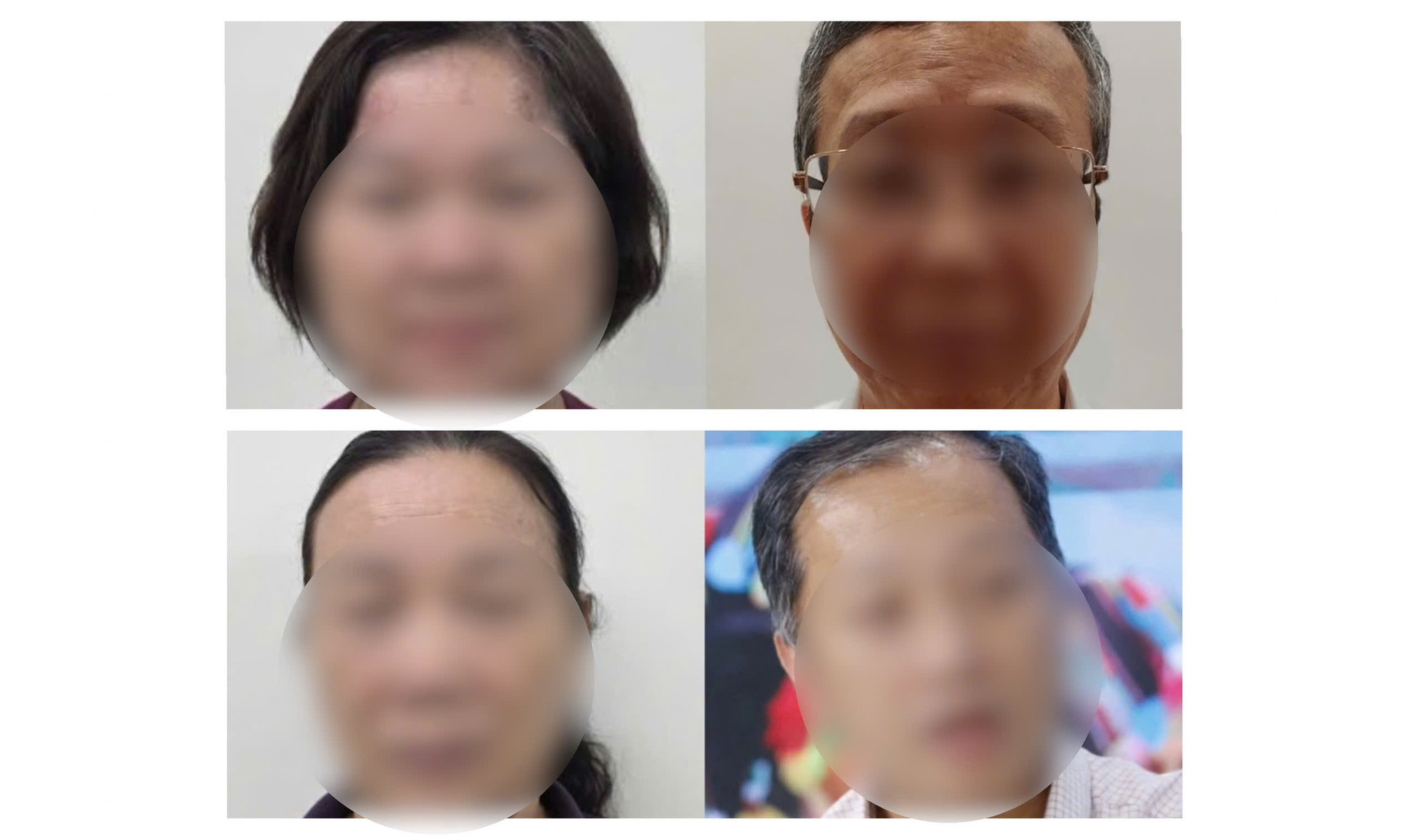 Hối lộ