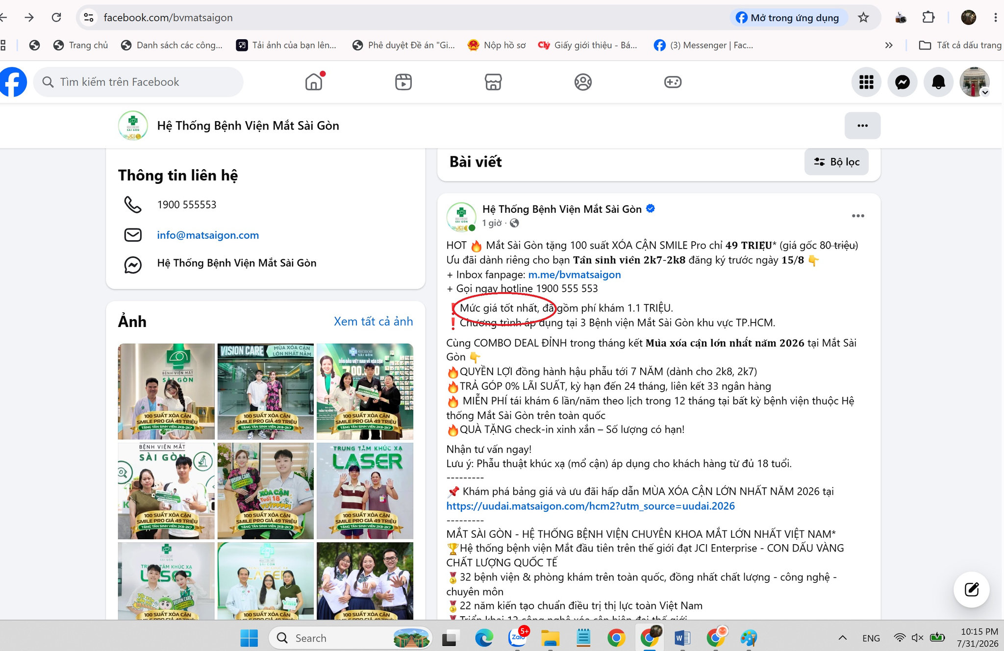 Hệ thống Bệnh viện Mắt Sài Gòn có thật là có mức giá tốt nhất? (Ảnh chụp màn hình trên fanpage của bệnh viện)