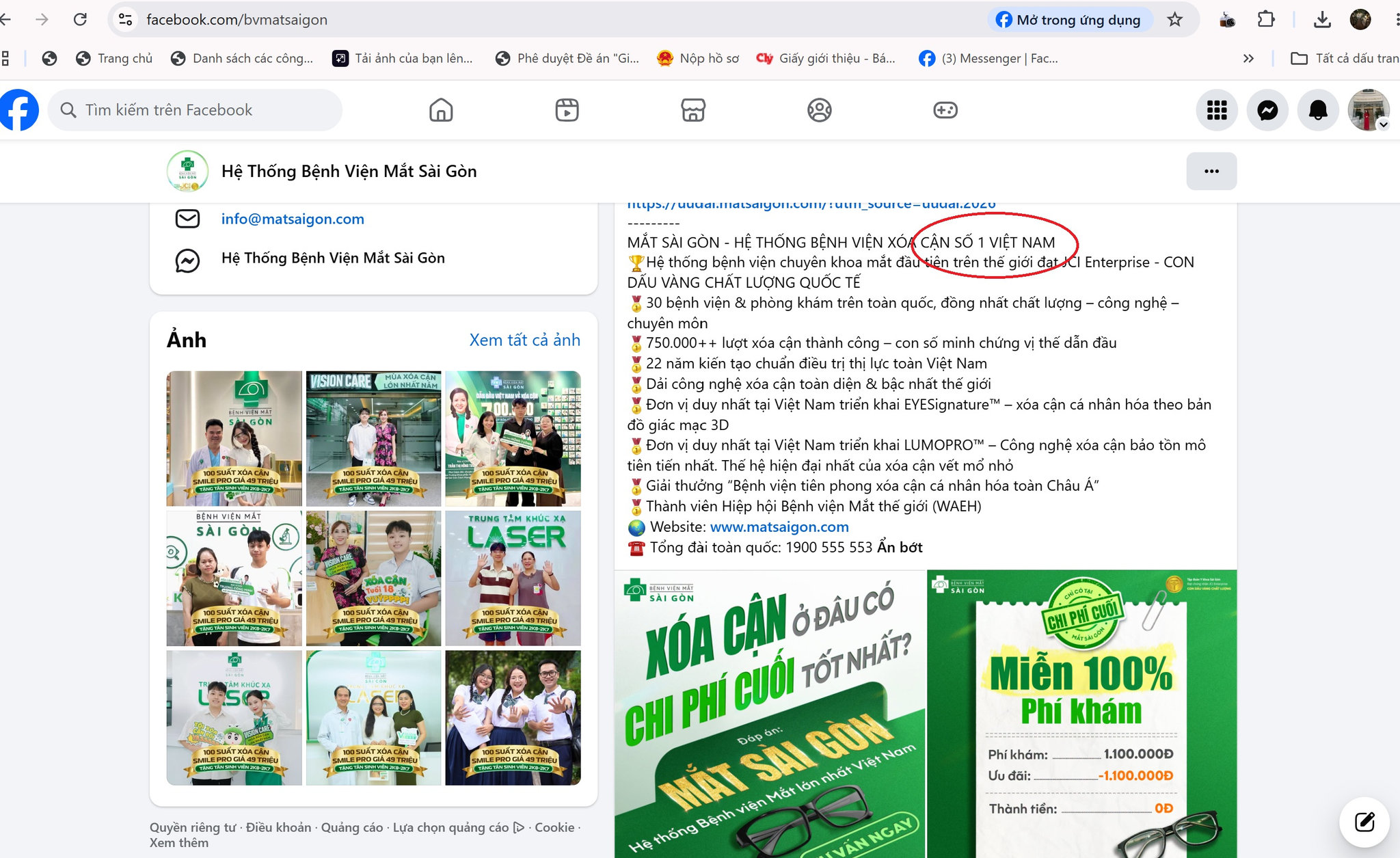 Hệ thống Bệnh viện Mắt Sài Gòn có thật là bệnh viện xóa cận số 1 Việt Nam? (Ảnh chụp màn hình trên fanpage của bệnh viện)