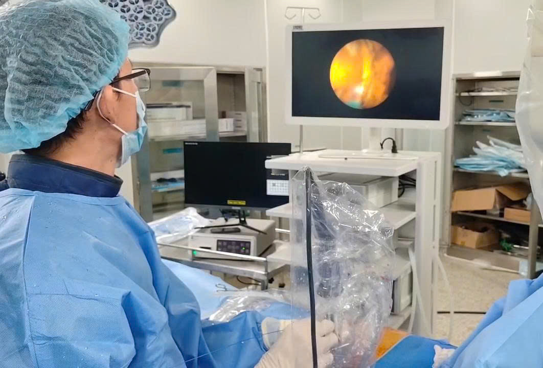 BSCKII. Trần Văn Do - Trưởng khoa Ngoại tổng hợp tán sỏi đường mật qua da cho người bệnh.