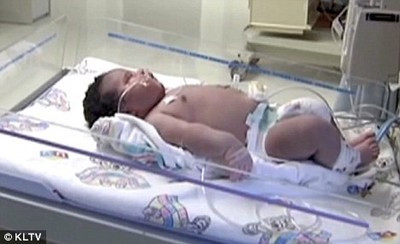 Bé sơ sinh nặng hơn 7kg