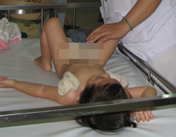 Không tiêm chủng bạch hầu, nhiều trẻ bị đe dọa tính mạng