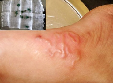 Rợn người những sinh vật kỳ dị sống trong cơ thể người Việt