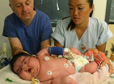 Những em bé sơ sinh có cân nặng “khủng”