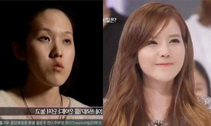 Cô gái xấu xí phẫu thuật thành "bản sao Jessica SNSD" gây sốt