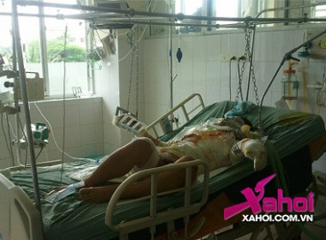 Hé lộ nguyên nhân nam thanh niên đổ xăng thiêu cả mình và người yêu