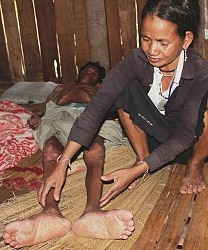 Bệnh “lạ” tiếp tục diễn biến bất thường ở vùng núi Quảng Ngăi