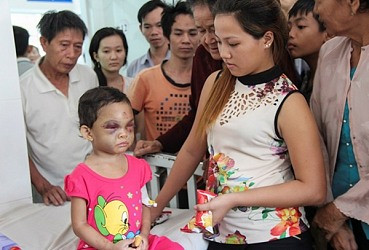 Trẻ bị bạo hành - cần sự vào cuộc của các tổ chức xã hội