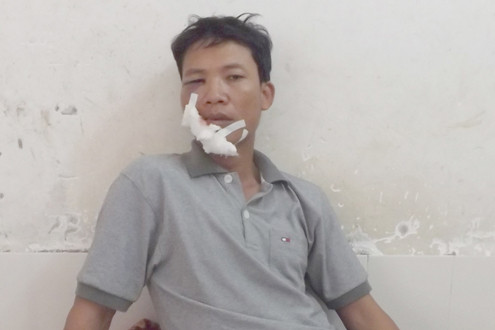 Sập giàn giáo thi công hầm đường bộ, nhiều công nhân bị thương